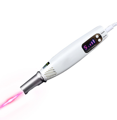 Orignal Laser Spider Veins Acne Mole Warts Freckles Remover - Minihomy